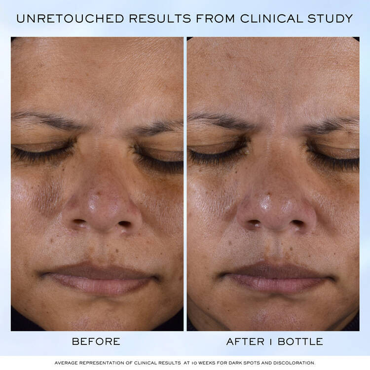 Clarifique Pro-Solution Serum | Lancome