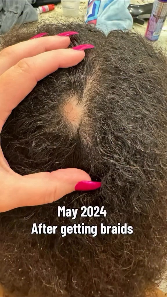 Scarlett got pony tail braids for our cruise back back in April of 2024 and when I took them out she had this bald spot! Her hair has grown so much since then!