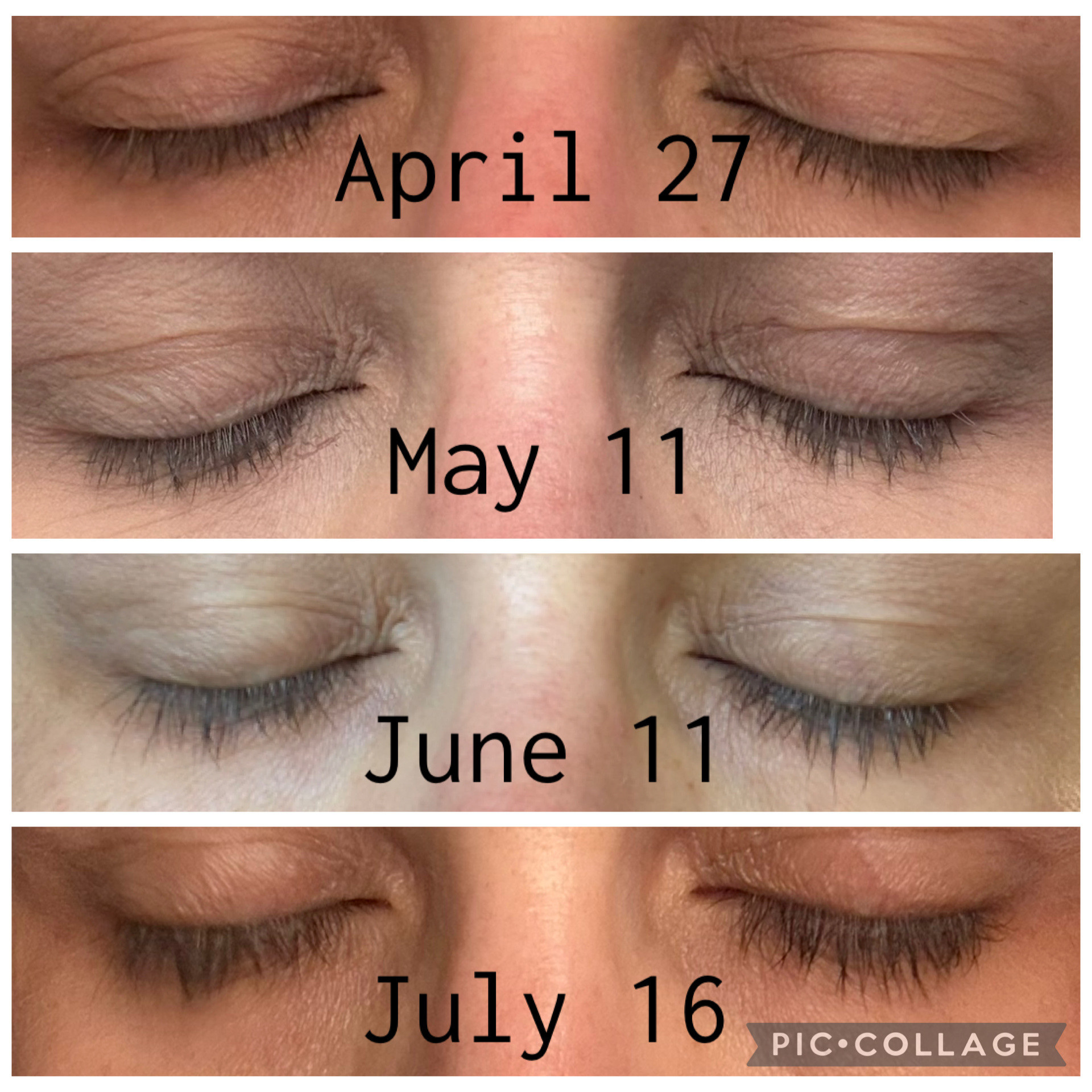 My GrandeLASH Results After Consistent Use 

I’ve been taking progress photos along the way, and seeing them side by side made such a difference. These are my real results after consistently using GrandeLASH. If you’ve been curious about adding a lash serum to your routine, I’ve linked the one I’ve been using.

#affiliate #gifted

#LTKBeauty #LTKOver40 #LTKmorningroutine