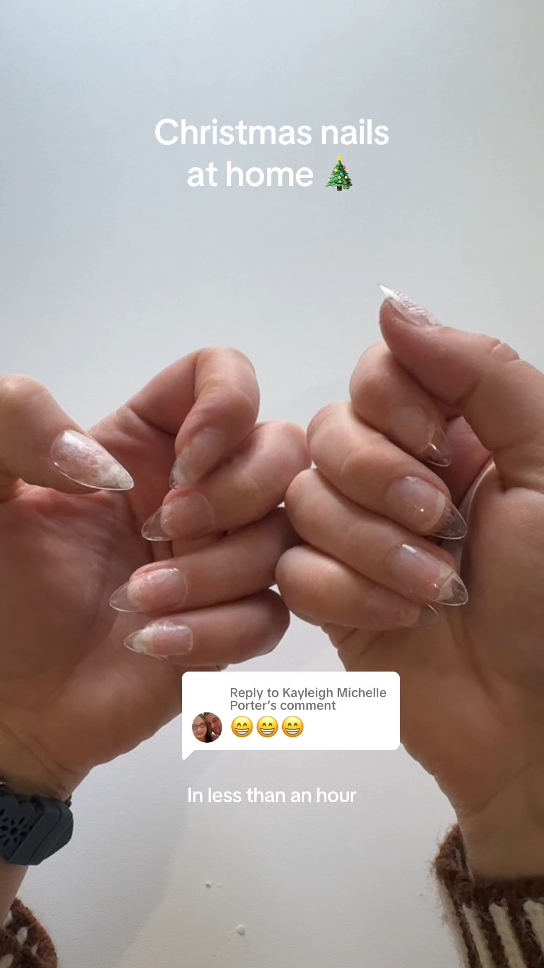 Create stunning nails at home with the AZUREBEAUTY 31-Piece Dip Powder Nail Kit! Featuring 20 gorgeous colors, including clear, nude, pink, brown, and glitter shades, this all-season set has everything you need for flawless DIY nail art. Complete with top/base coats, activator, and dipping liquids, it’s perfect for French manicures or creative designs. Whether you're a beginner or a pro, this kit delivers salon-quality results with long-lasting, chip-resistant finishes. A fabulous gift for nail enthusiasts or a treat for yourself!

DIY nails, all-season beauty, Amazon, salon-quality, versatile colors, perfect gift. 

 #LTKGiftGuide #LTKWatchNow #LTKStyleTip