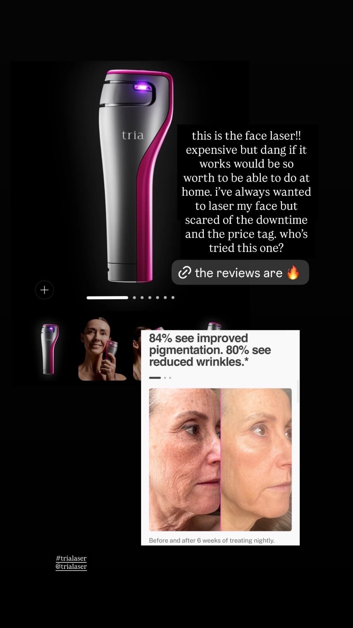 Face laser that is suppose to help with angry aging, wrinkles, and unwanted pigmentation! So excited to try this! 

#LTKgrwm #LTKmorningroutine #LTKselfcare