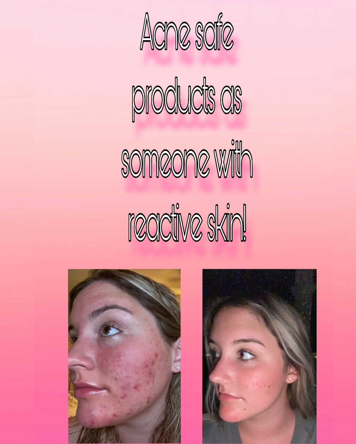 I have PCOS + Hashimoto’s so I am very familiar with cystic acne🥲 my skin type is oily and these are products that I have tried over the past few years that have not yet done me wrong! All products I personally used for a minimum of 3 months and some have been consistent in my routine for years. #acnesafe #skincare #hormonalacne

#LTKselfcare #LTKBeauty