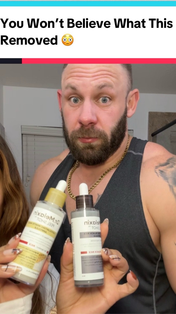 @Drmelaxin peel shot duo = pore-clearing PERFECTION 🤌🏼✨ soft, smooth, exfoliated skin + a holiday discount… run don’t walk! This is viral for a reason!! #drmelaxin #peelshot #skincareproducts #skincare 

#LTKSaleAlert #LTKBeauty #LTKGiftGuide