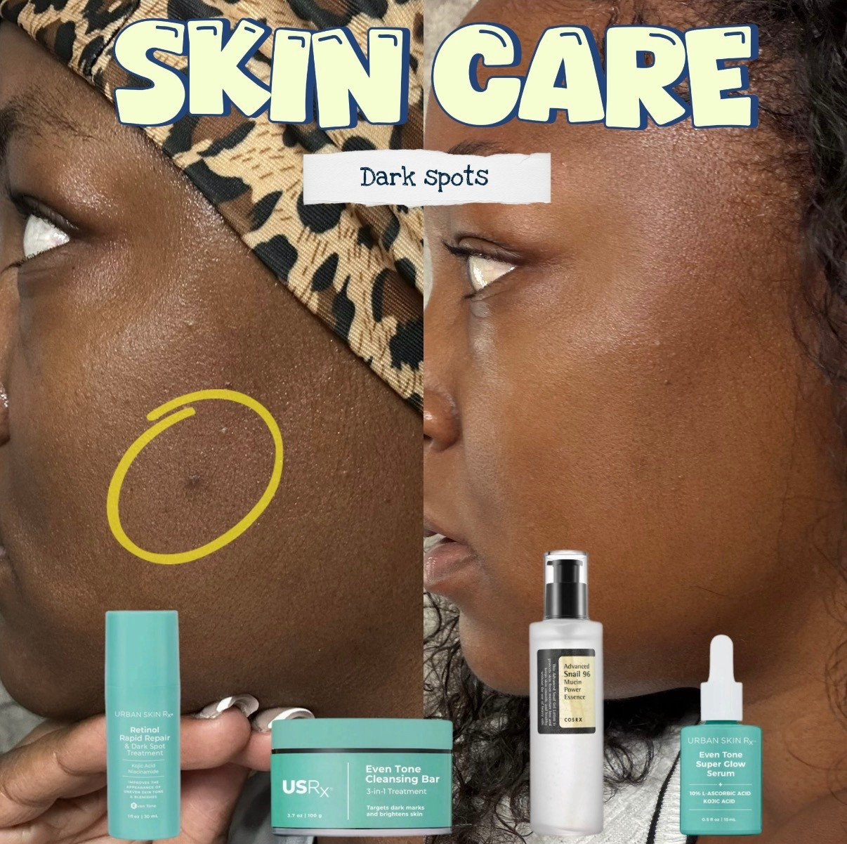 My Dark Spot Routine — Fading Hyperpigmentation

Real results, no filter !! These are the products I use to keep my skin clear and even-toned! 💫

🧼 Urban Skin Rx Even Tone Cleansing Bar
💧 COSRX Snail Mucin Toner
🌙 Urban Skin Rx Retinol Rapid Repair
✨ Urban Skin Rx Super Glow Serum

I use these 3–4 times a week and always finish with sunscreen during the day!

#LTKbeauty #LTKskincare #LTKglow #skincareproducts #hyperpigmentation #darkspots #melaninskincare #skincareroutine #selfcarebeauty #LTKfinds


#LTKU #LTKBeauty