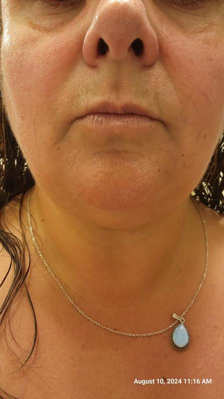 Super Multi-Corrective Anti-Aging Face & Neck Cream | Nordstrom