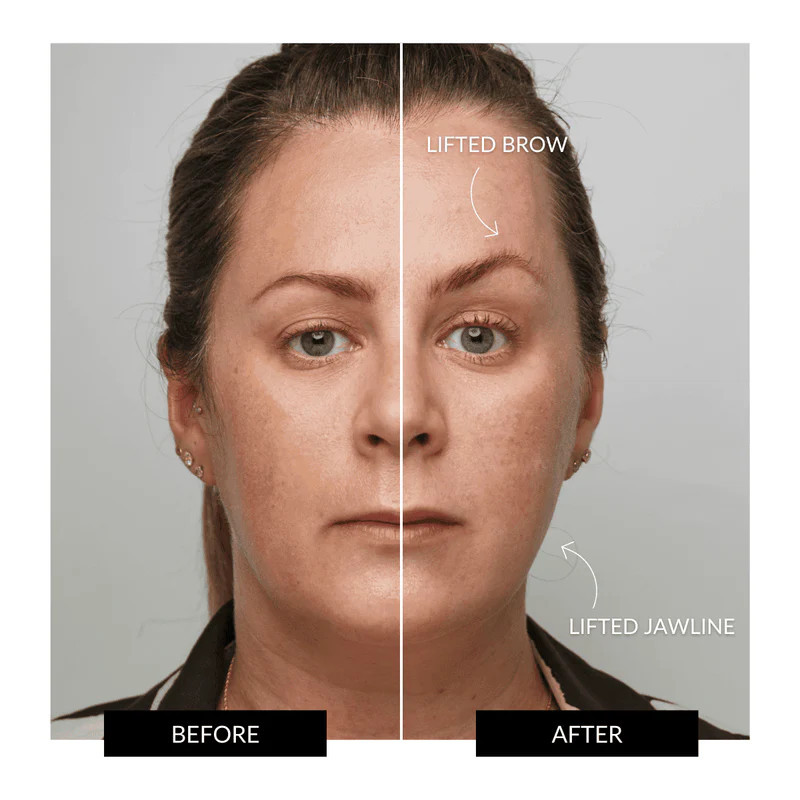 ZIIP HALO | Microcurrent Facial Device | CurrentBody | Currentbody US & Canada