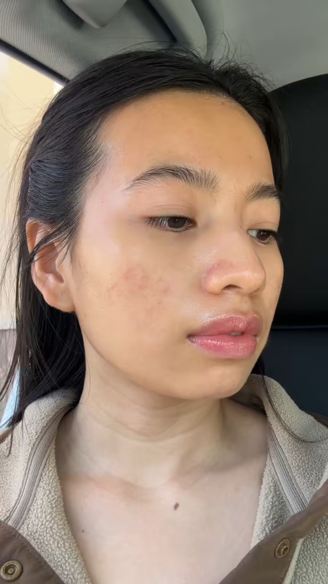 For my acne prone girlie, Vichy moisturizer and especially spot treatment are my acne saver! Between the 2, i would highly recommend the spot treatment. It works like a charm. It makes my pus disappear in a week and it doesn’t dry out my skin like other ones! 

#LTKselfcare #LTKBeauty