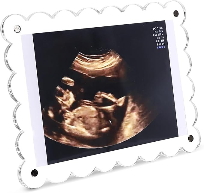 Magnetic Clear Acrylic Scalloped Baby Ultrasound Picture Frame - Sonogram Frame for Refrigerator,... | Amazon (US)