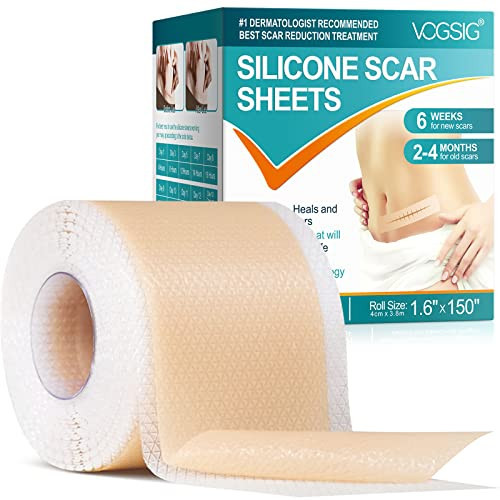 Silicone Scar Sheets,Silicone Scar Tape Roll,Soft Silicone Tape,Reusable Scar Patch for C-Section, Keloids, Surgical, Acne Roll Size 1.6"*150" | Amazon (CA)