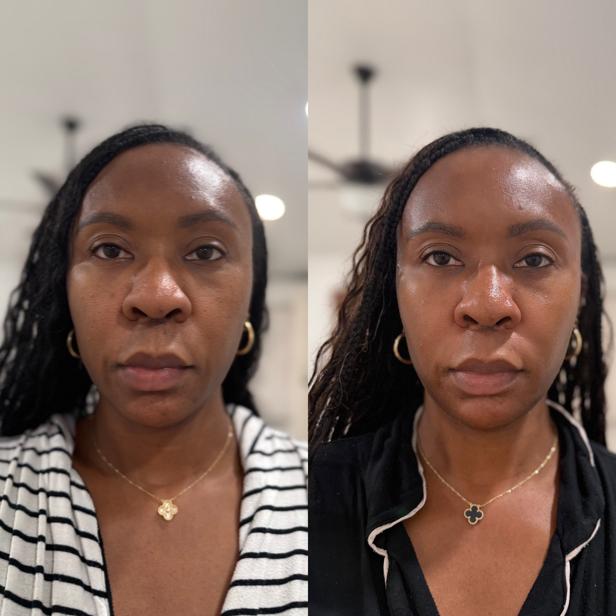 The Glow is REAL! WOW. Before and afters tell a huge story. Current Body LED masks is a game changer! 