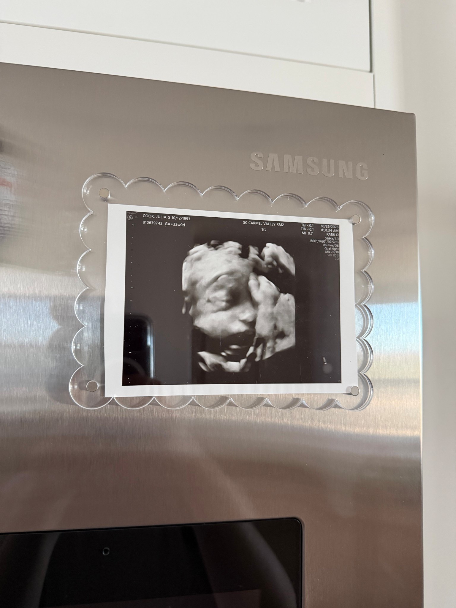 Magnetic fridge frame for ultrasounds (or any little frame) 

Fridge frame, ultrasound frame, magnetic frame, baby frame, Amazon finds, Amazon home, Amazon baby 

#LTKHome #LTKBaby