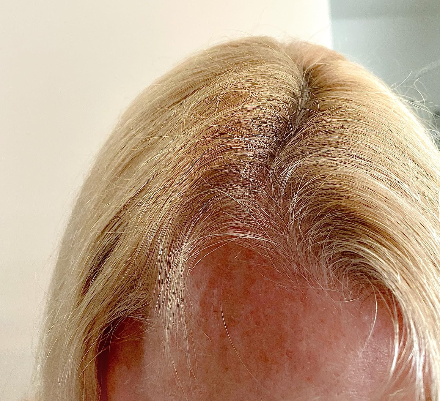 Nutrafol Women's Balance Hair Growth Supplements, Ages 45 and Up, Clinically Proven for Visibly T... | Amazon (US)