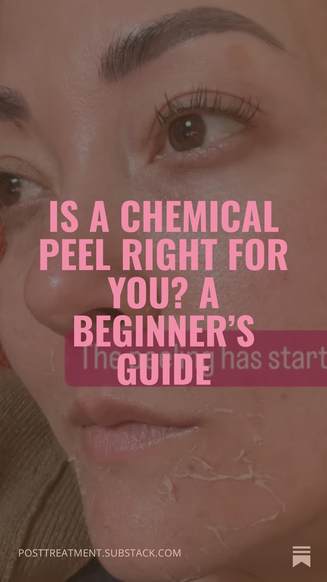 After a chemical peel I recommend clients use this gentle cleanser and SPf 

After day 4 I add a peptide serum. 

3 days After active peeling is complete I return to normal skincare  

#LTKBeauty #LTKselfcare #LTKfitnessgoals