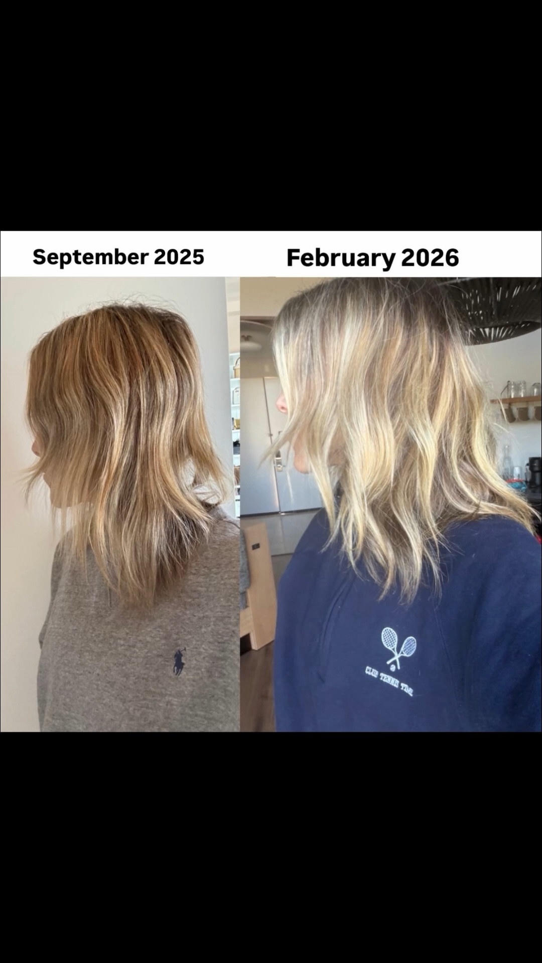 Everything I use on my hormonal hair 

#LTKselfcare