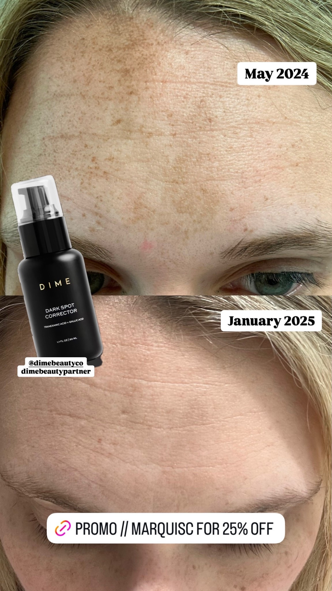 An easy Christmas gift idea for anyone who loves skincare! The DIME Dark Spot Corrector is perfect for helping brighten and even skin tone—such a thoughtful gift!

#LTKBeauty #LTKHoliday #LTKselfcare