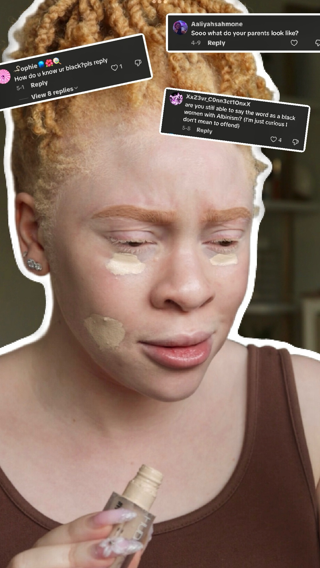 Things we as Black people with albinism need you to stop asking us.🫠 
.
What is albinism? Albinism is the lack of melanin or pigmentation in the skin, hair and eyes. You can be ANY race or ANY ethnicity to be born with albinism. Albinism is genetic is only passed down through genes. Albinism is beautiful 🌟
.
#albinism #albinismisbeautiful 


#LTKBeauty #LTKStyleTip #LTKFindsUnder50