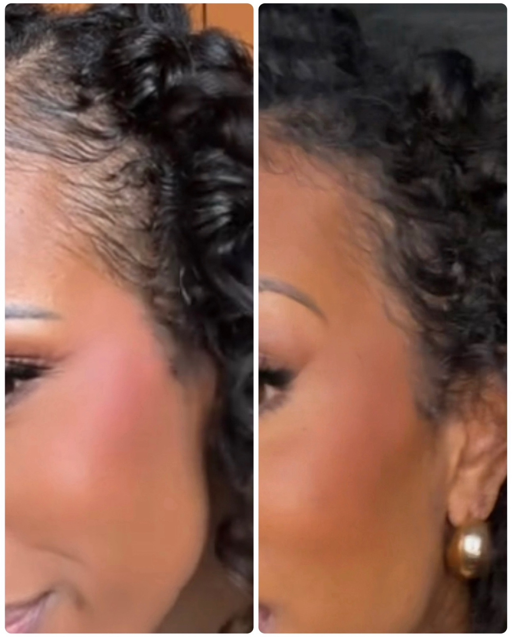 What helped me get my edges back 😩 this is a before and after just three months apart 