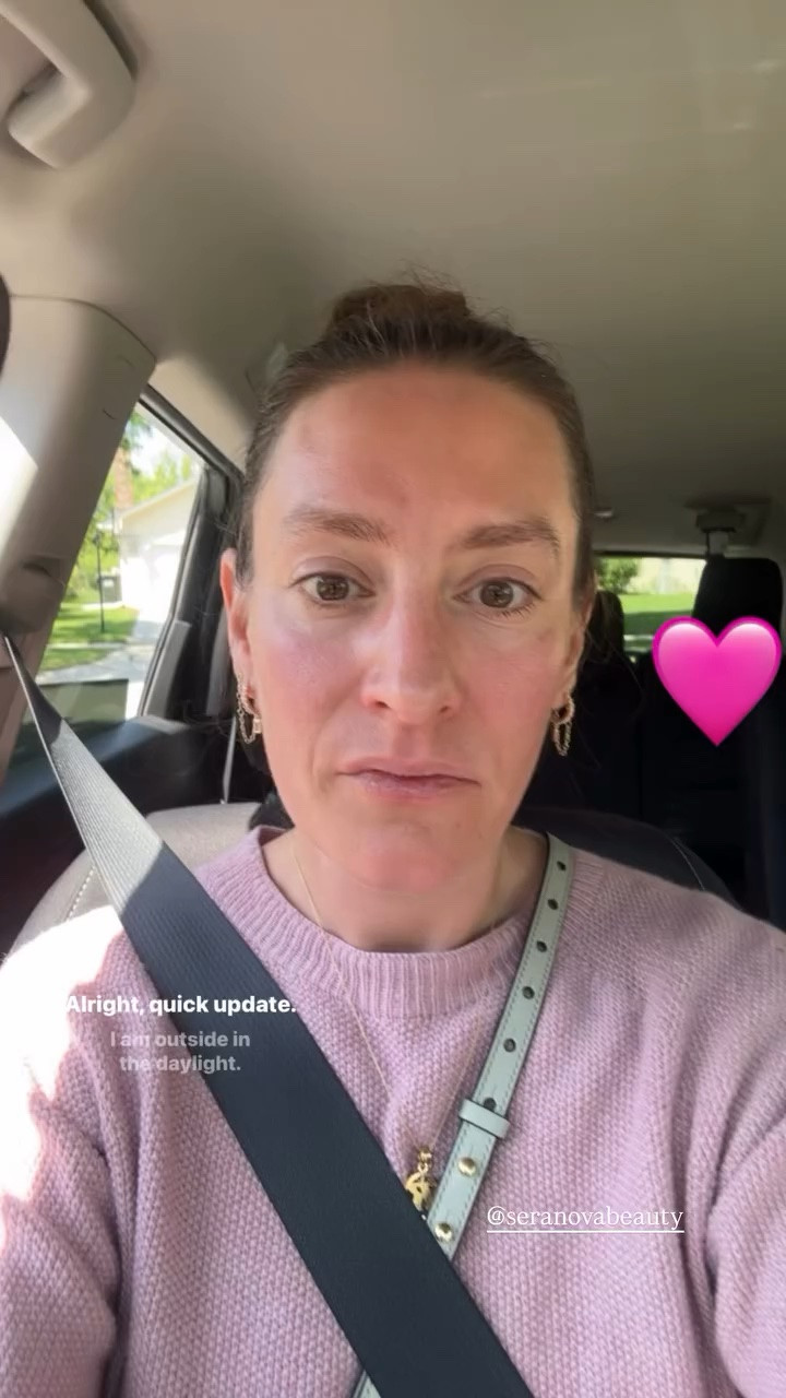 Seranova Microneedling: One Hour Post Treatment

#LTKselfcare