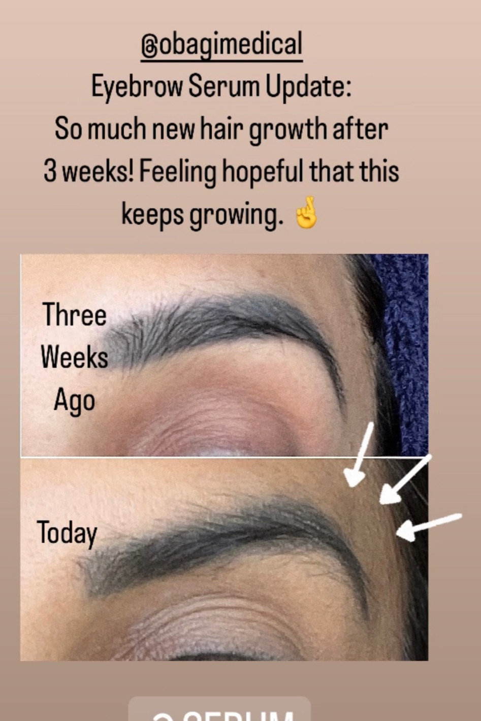 So excited to have thicker eyebrows again. 

#LTKstyletip #LTKbeauty #LTKover40