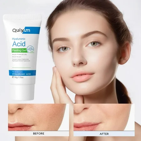 Hyaluronicacid Exfoliates Cleans Facial Skin Hyaluronicacid Peeling Gel Smoothing the Skin Leodye Beauty & Personal Care | Walmart (US)