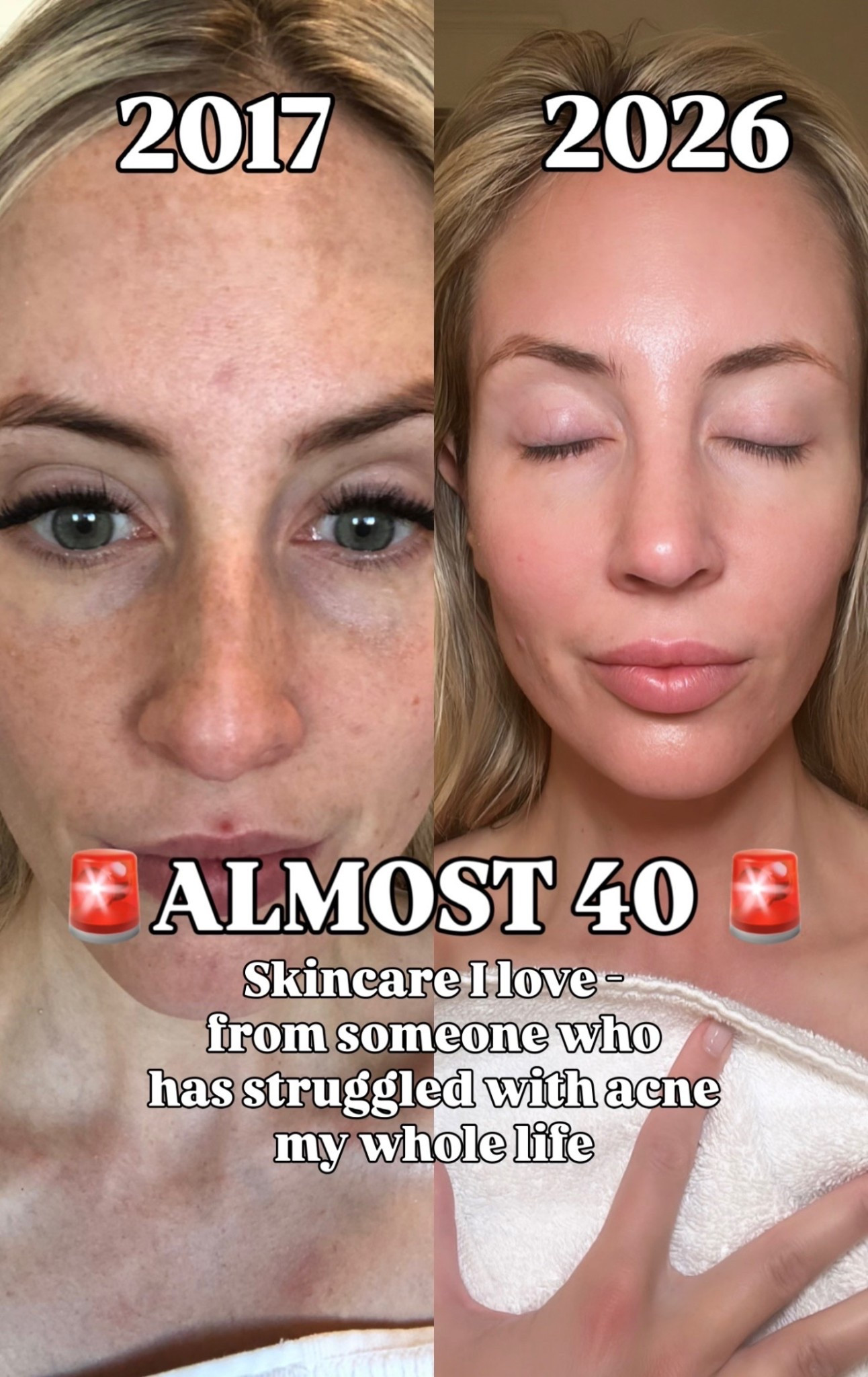 Skincare I love from someone who has struggled with aene my whole life!