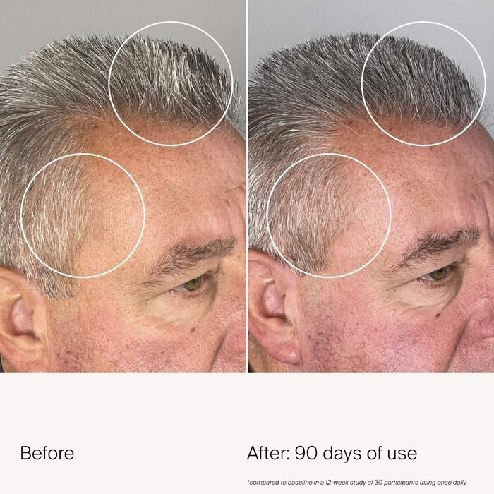 Scalp Care Density Serum for Thinning & Greying Hair | Sephora (US)
