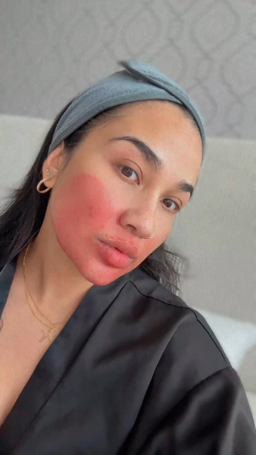 Sunday Exfoliating Ritual

My skin has definitely been going through it lately—sensitivity, texture, hyperpigmentation, and the occasional eczema flare-up. If you’re in the same boat, you’re not alone.

I’ve been easing back into active treatments and only applying The Ordinary AHA 30% + BHA 2% Peeling Solution to my problem areas. It’s helped with texture and tone, but I’m being super cautious since exfoliants and acids have also made my skin lighten a bit.

Hoping to get things back on track by the end of the month. I’ll post the full routine and updates soon—stay tuned!
#sensitiveskin #skincare 

#LTKFindsUnder50 #LTKBeauty #LTKFindsUnder100