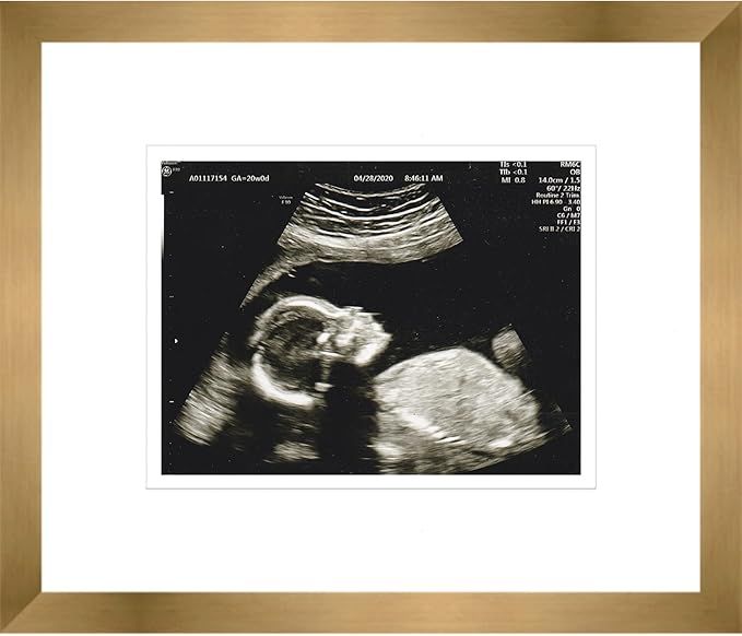 CountryArtHouse 6x5 Gold Sonogram Frame with White on White Mats with 1 Opening to Display 1 4x3 ... | Amazon (US)