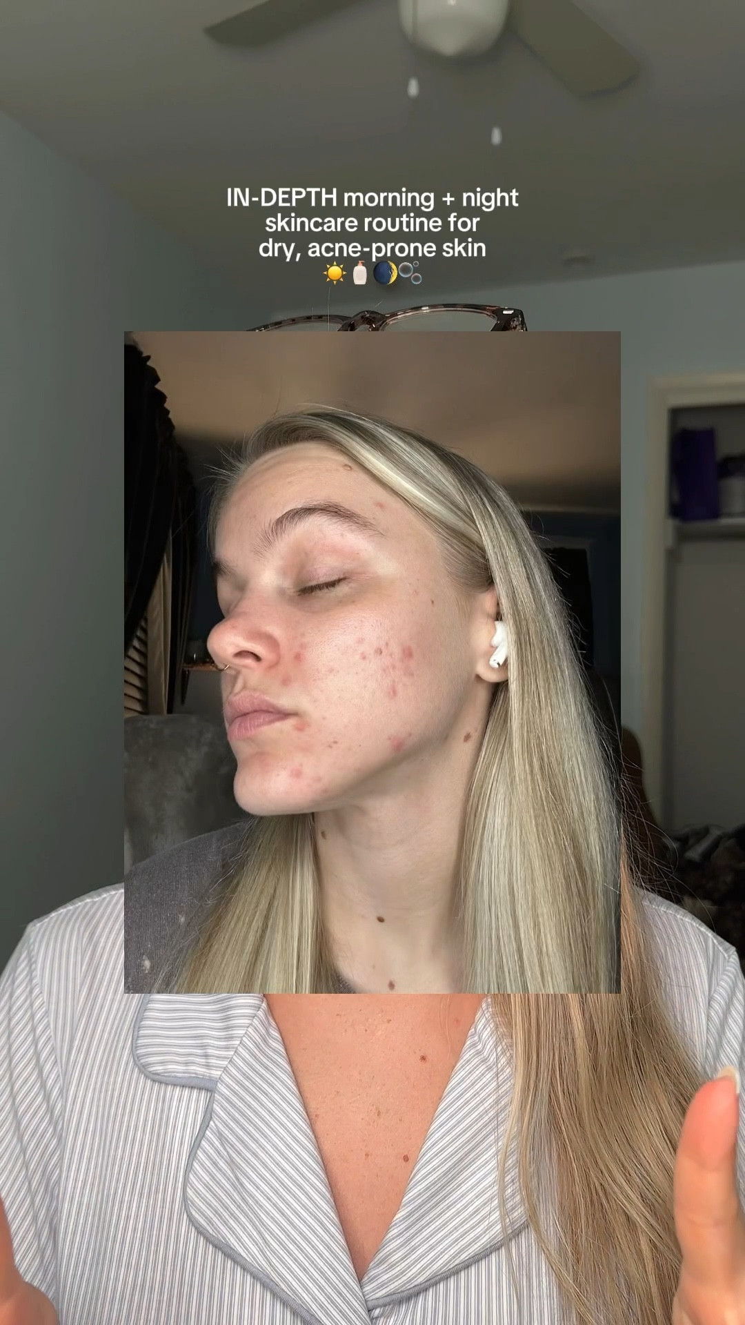 full morning and night skincare routine for dry, acne-prone skin