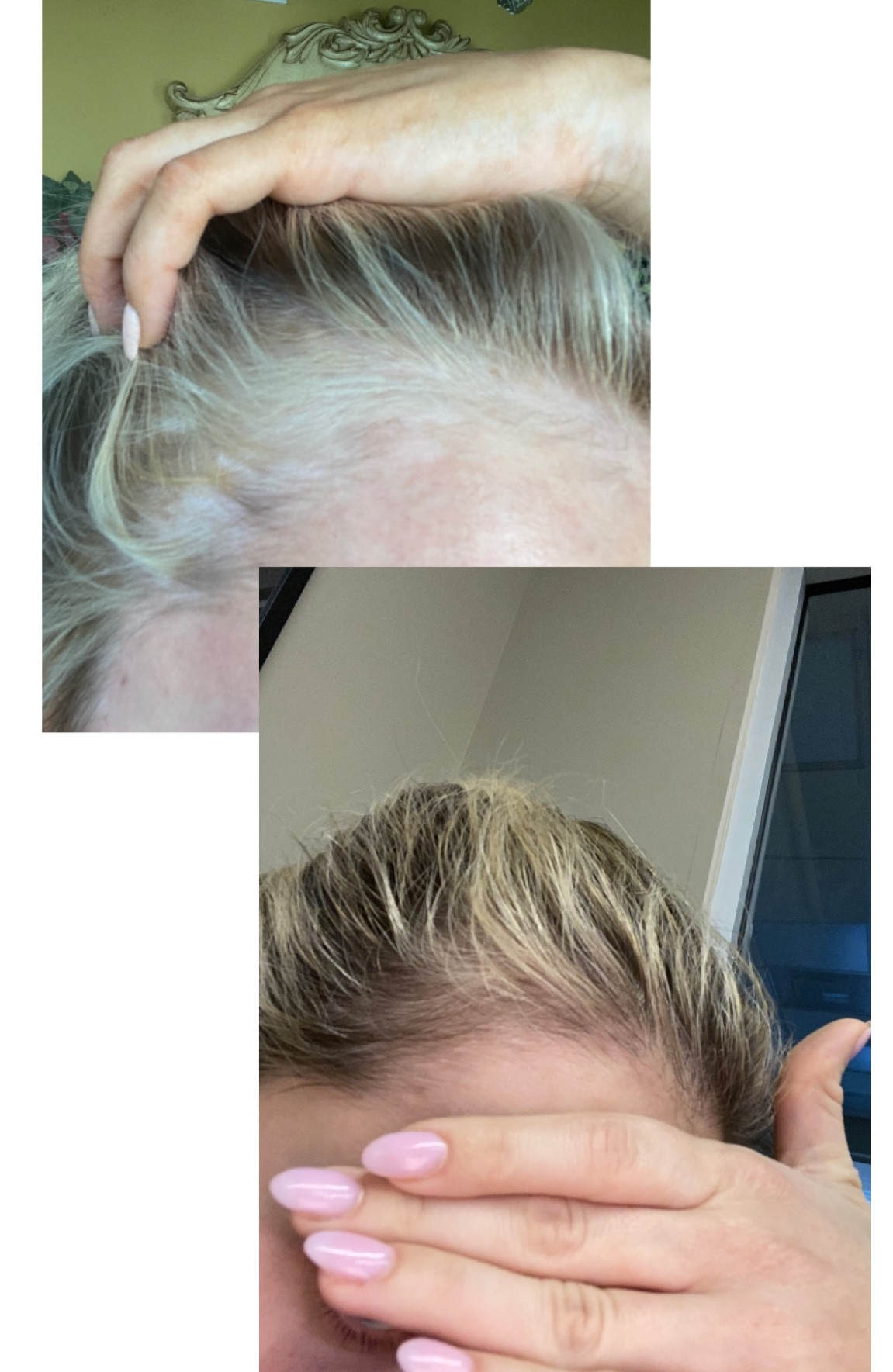 Shop my holy grail products that helped stimulate hair growth for me in less than two months 🤩 

#LTKunder50 #LTKstyletip #LTKbeauty