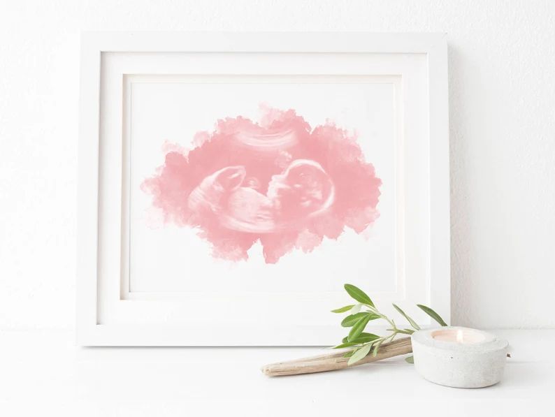 Ultrasound Art Print Watercolor Sonogram Mom to Be Dad to | Etsy | Etsy (US)