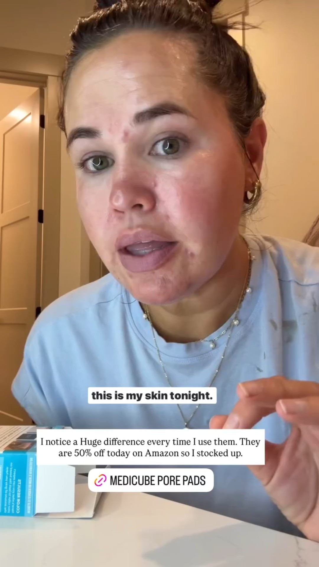 I notice a Huge difference every time I use these pore pads. They are 50% off today on Amazon so I stocked up.