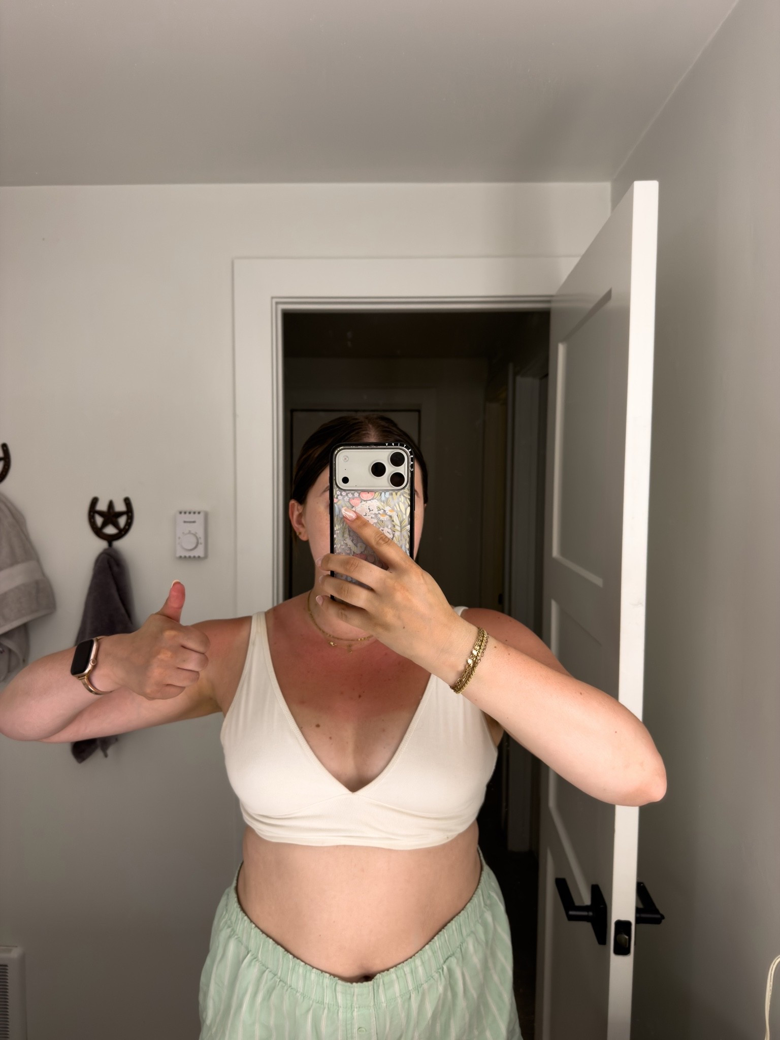 My pjs featuring the lovely sunburn I got at the wedding 😆 Anyone burn like a disco inferno??

#LTKMidsize #LTKdayinmylife