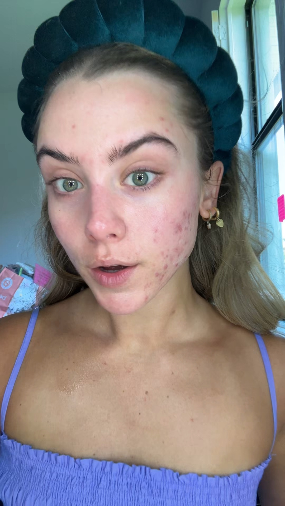 No makeup makeup for my Botox appointment so get ready with me. I used the eltamd tinted spf mixed with dibs beauty (code SLOANE) LoveBeam Perfector in shade 2. I used the Haus labs shade 24 concealer to cover up the acne. Benefit cosmetics brow setter for my clear eyebrow gel. My lips are lawless beauty lip liner in pink slip and OLEHENRIKSEN in glimmer sunshine for mega hydration. Anastasia Beverly Hills impeccable setting spray. Always curl the lashes. For my cream bronzer I used the dibs beauty desert island duo shade 4 and the blush too. 

#fiveminutemakeup #fiveminutemakeuproutine #minimalmakeup #summermakeup #summermakeuproutine #getreadywithme #getready #grwm #makeup #getreadywithmemakeup #grwmmakeup #fyp #makeuptutorial #makeuphacks #makeuproutine #makeuptips #naturalmakeup #naturalmakeuplook #nomakeupmakeup makeup, makeup routinue, makeup tutorial, five minute makeup look, natural makeup, get ready with me, grwm makeup 

#LTKU #LTKBeauty #LTKFindsUnder50