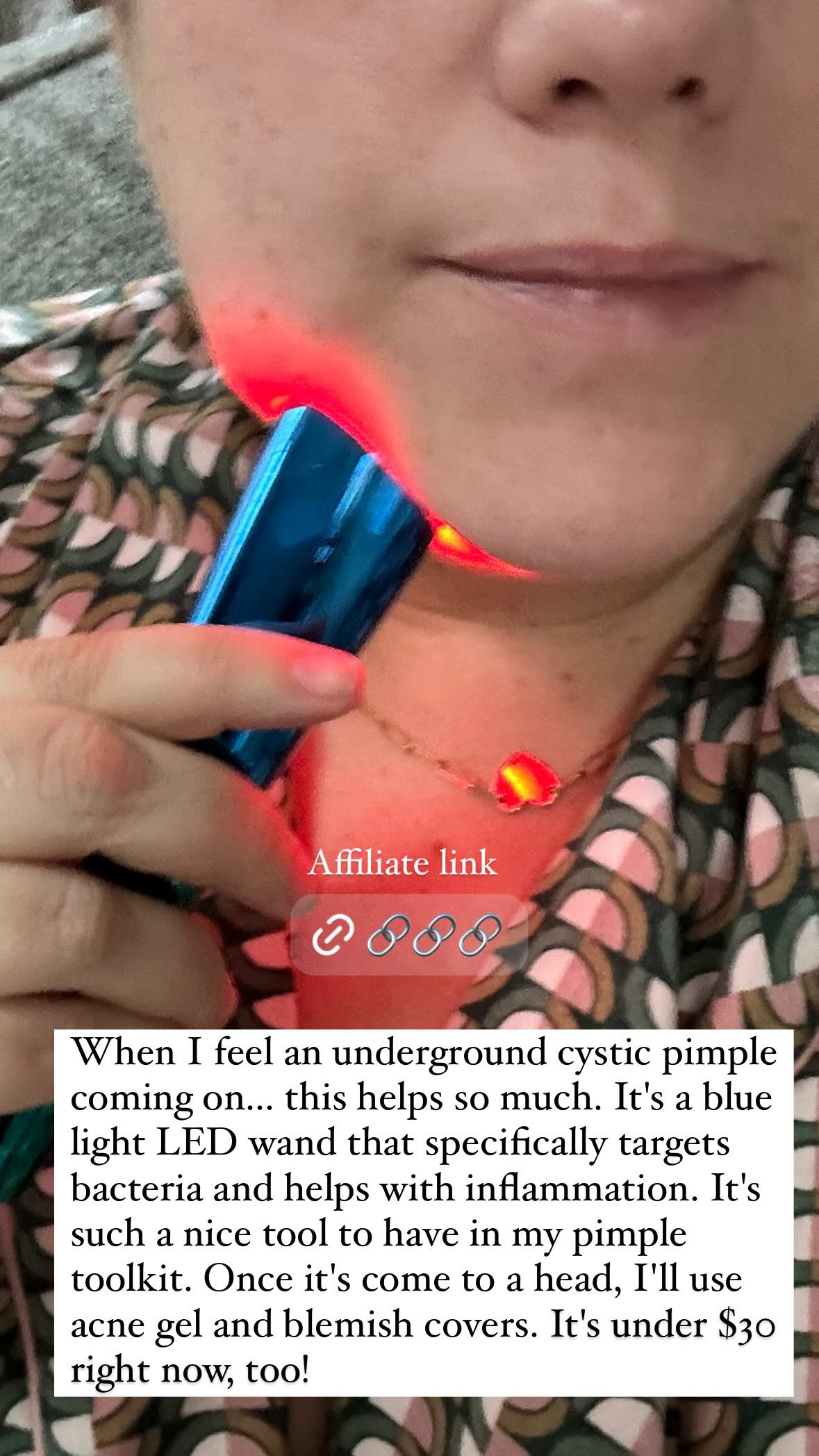 This light is so helpful when I feel a cystic pimple coming on.  

 #LTKFindsUnder50 #LTKBeauty