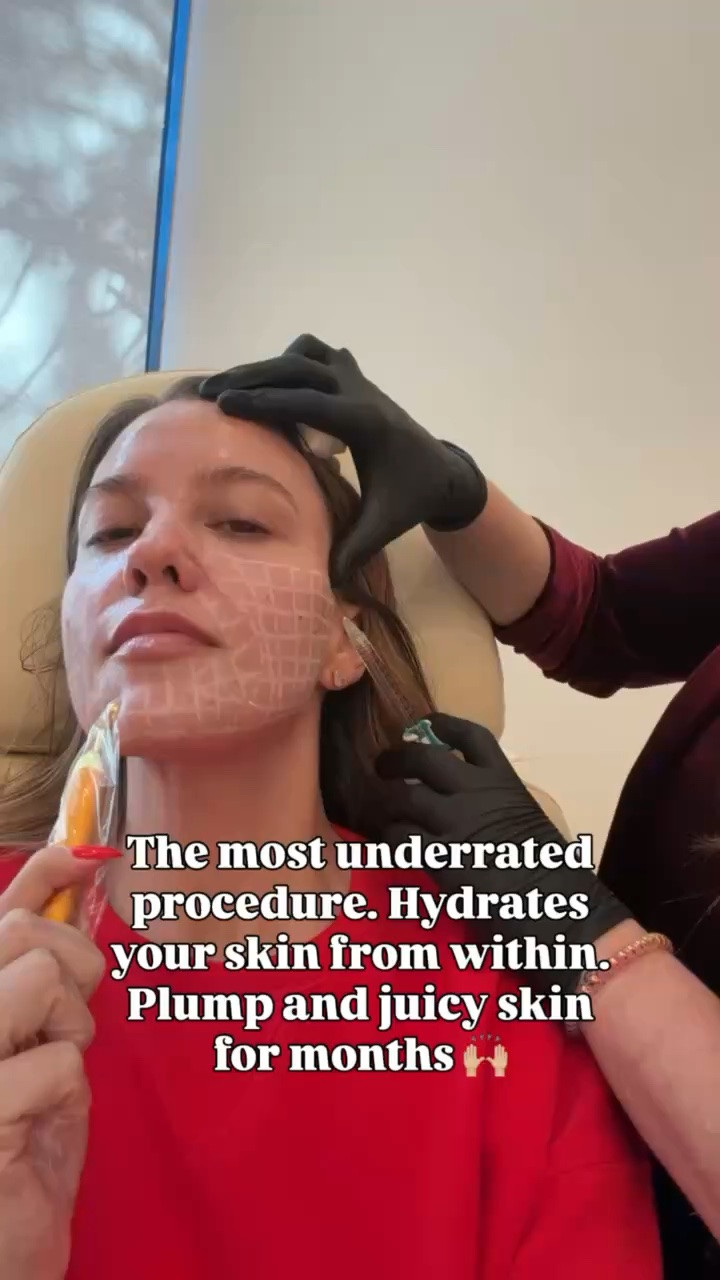 My go-to procedure fot gorgeous, hydrated skin! The procedure is important but how you take care of your skin after is too! I tagged all my favorite skincare must haves!

beauty procedure, beauty hack, glass skin, beauty injections, anti-aging, wellness lifestyle, skincare routine, hydrating skincare
