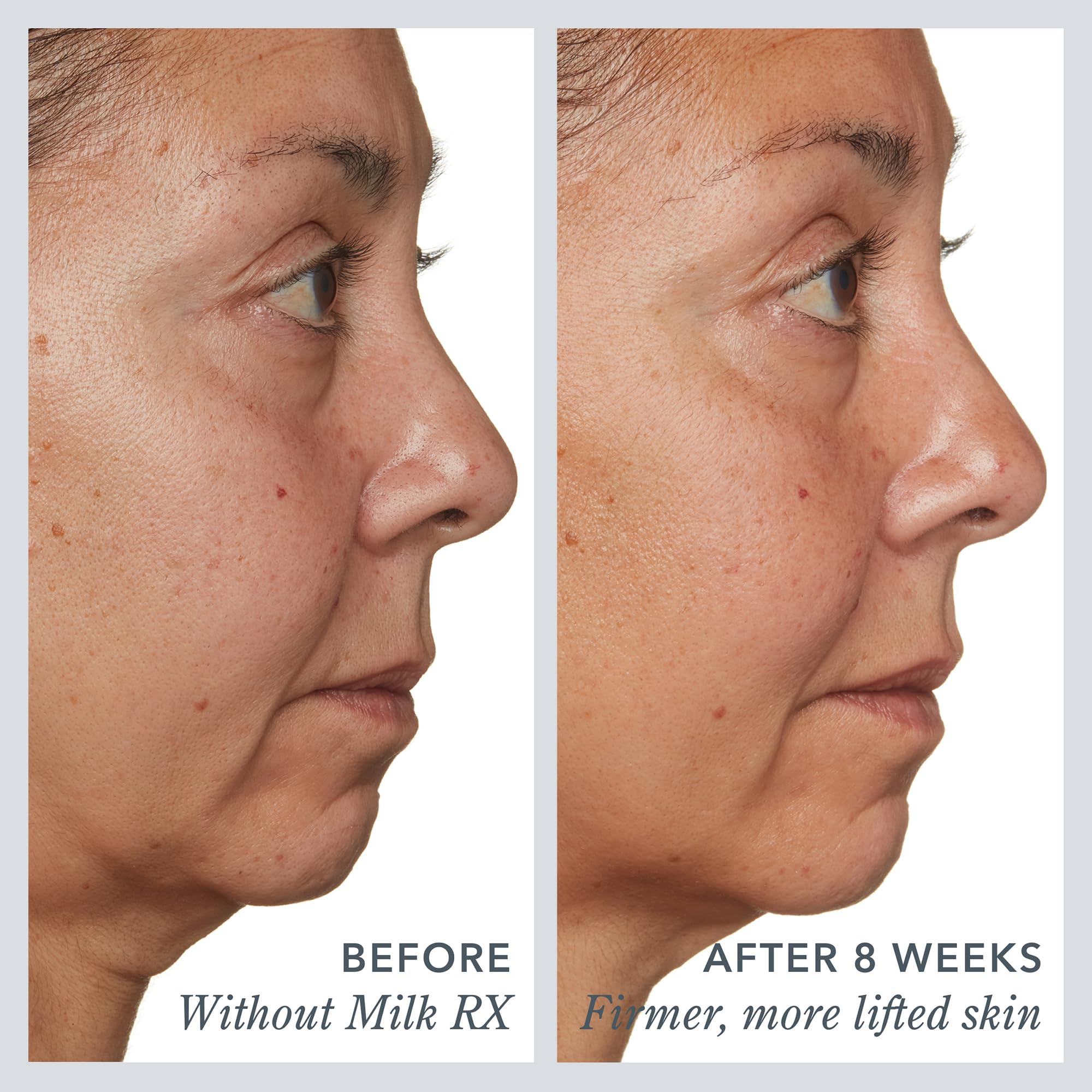 Beekman 1802 Milk RX Advanced Better Aging Collagen Moisturizer Face Cream – 4X Retinol Alterna... | Amazon (US)