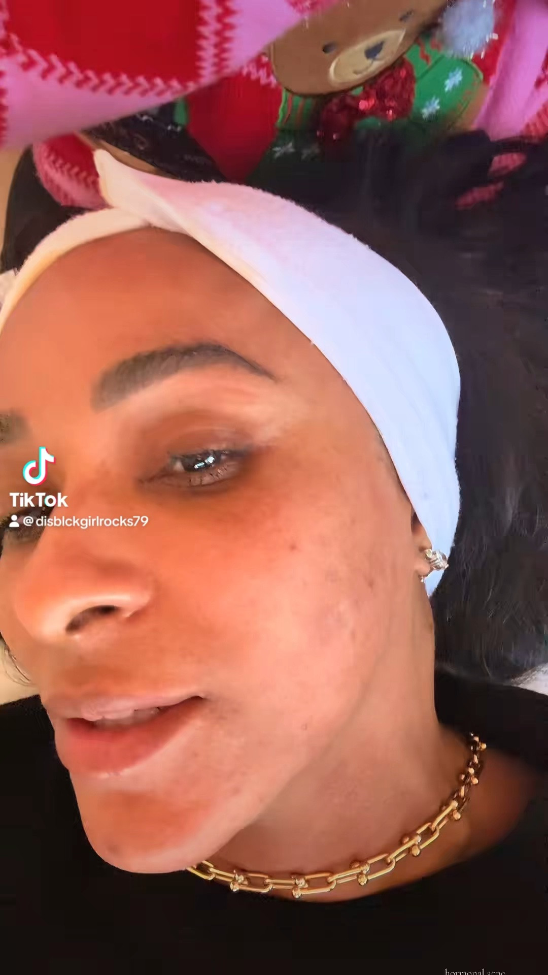 Hormones, HRT AND ACNE!!! But we can beat this ladies!

#LTKvlog #LTKselfcare #LTKBeauty