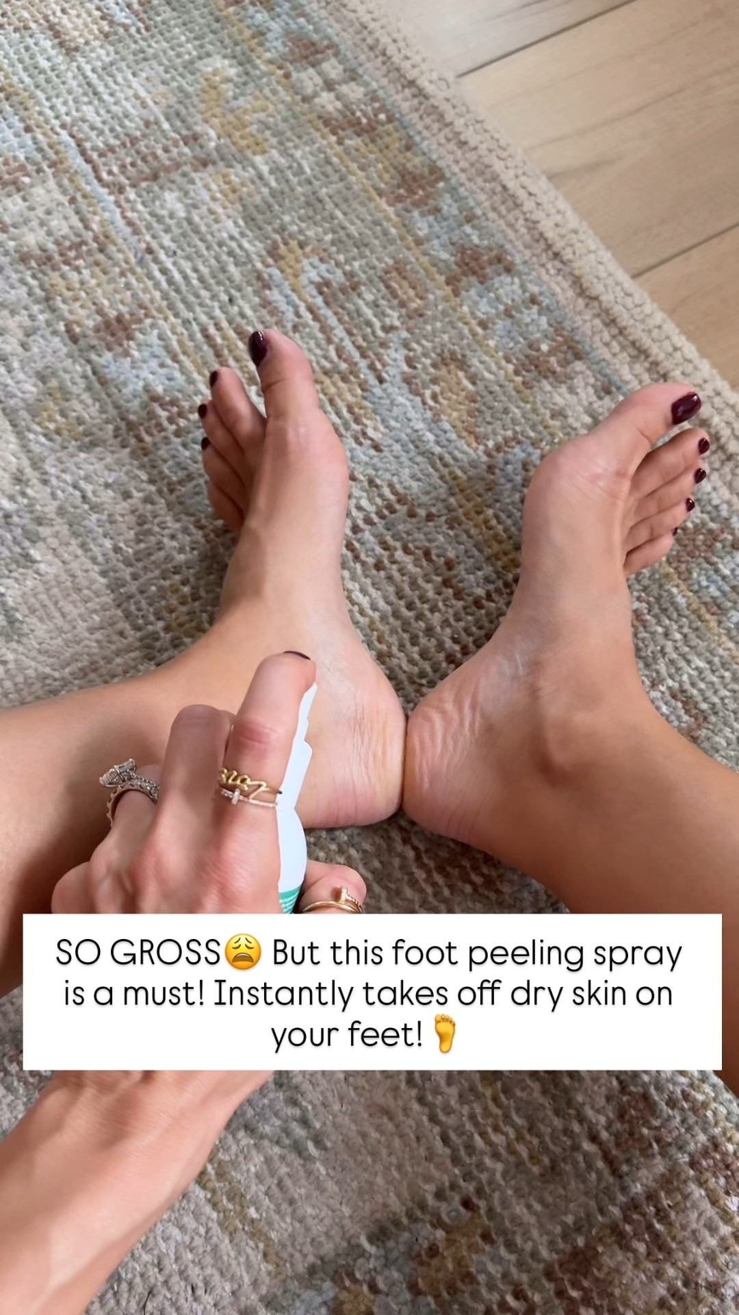 This foot spray is so gross but it WORKS! I spray the bottles of my heels and rubs them and the dead skin will instantly peel off. The best $5 you will spend! 

#LTKGiftGuide #LTKBeauty #LTKselfcare