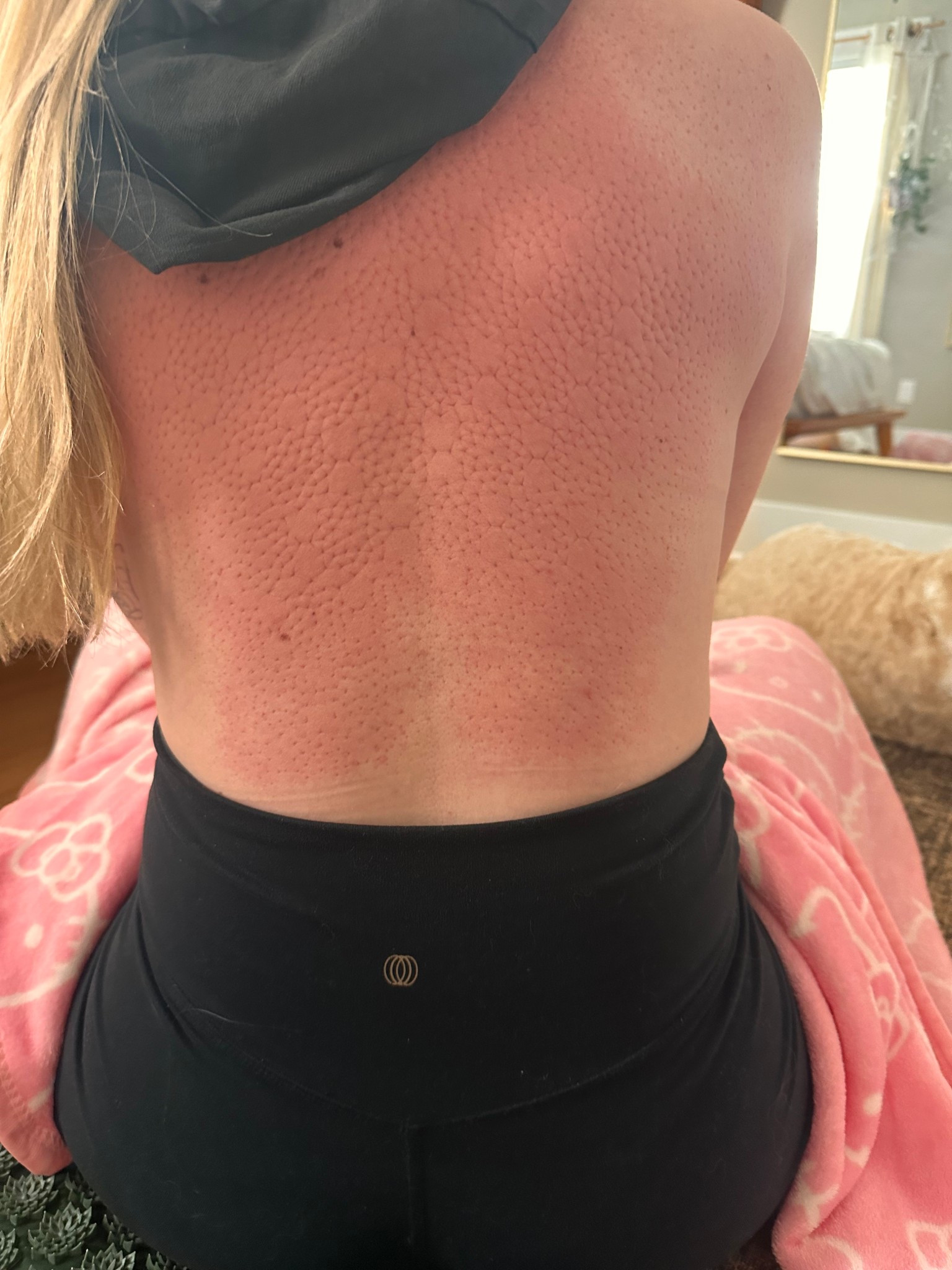 Why I love my Acupressure mat ✨

If you’ve ever wondered what all the hype is about, here are 5 reasons to give an acupressure mat a spot in your daily routine:

Natural Pain Relief – Say goodbye to tension headaches, neck & back pain without reaching for meds.

Better Sleep – Just 15–20 mins on the mat helps calm the nervous system and prep you for deeper rest.

Stress & Anxiety Relief – Instantly grounds you and brings your body into a relaxed state.

Energy Boost – Increases circulation and helps you feel refreshed and focused (great in the morning!).

Muscle Recovery – Perfect post-workout tool to support recovery and reduce soreness.

#LTKActive #LTKHome #LTKSummerEdit