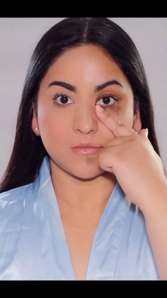 Before / after of Make Up Forever’s HD Skin! The best product for covering up.

#LTKsalealert #LTKCyberWeek #LTKbeauty