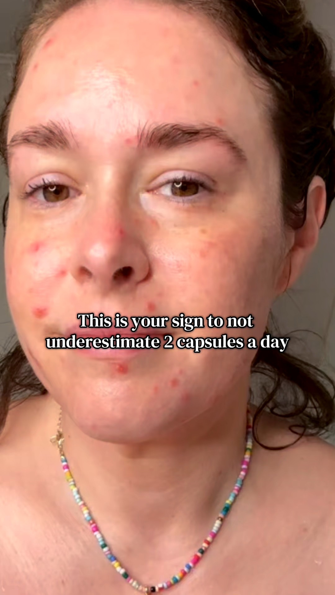 The glow my face deserved! My hormones were out of control! Clear 3 was the answer!

#LTKBeauty #LTKstorytime #LTKselfcare