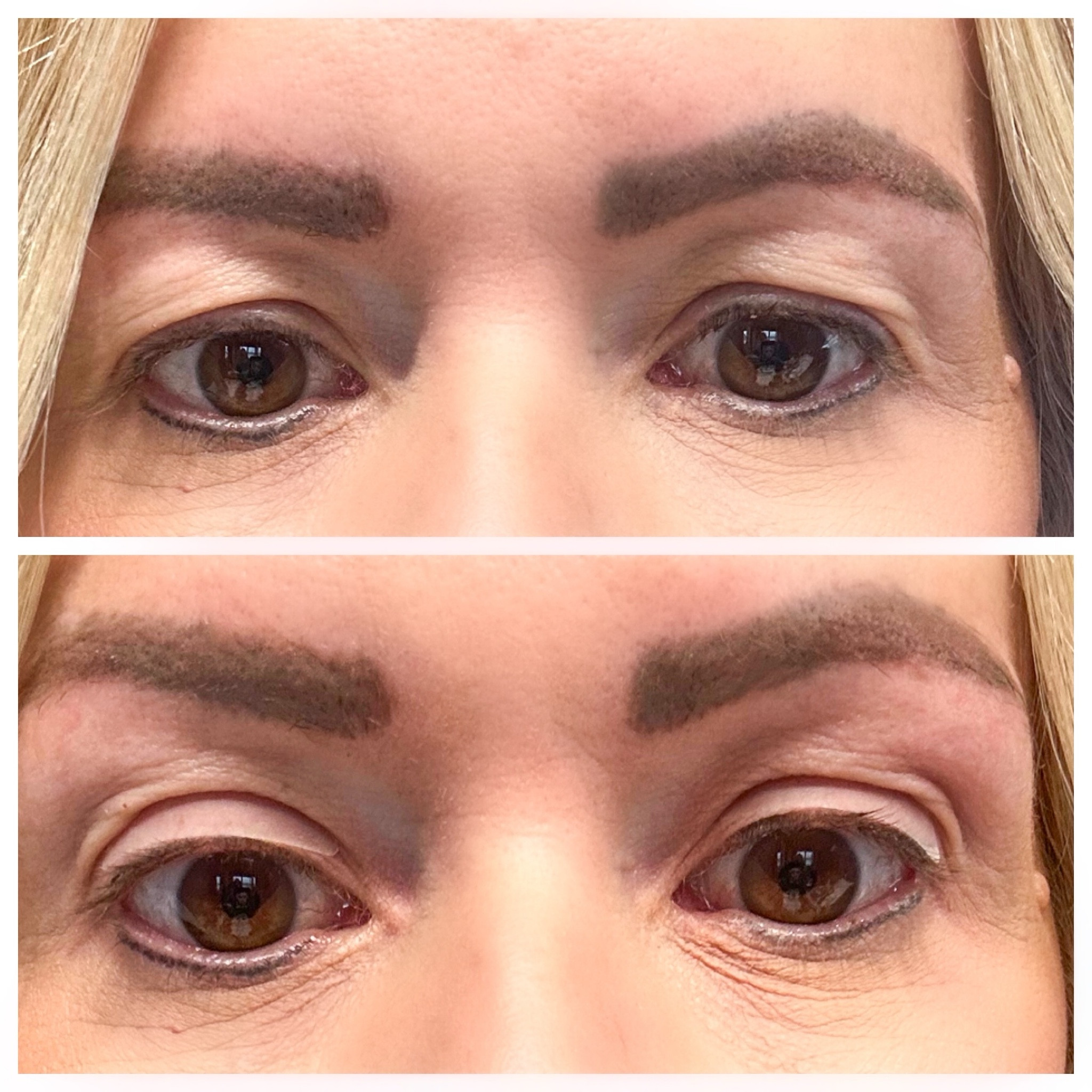MIND.BLOWN My eyelids have become SO saggy over the past few years that I am considering revision surgery but for now I found the BEST solution!

The "Contours Rx Lids By Design - Medical Grade Instant Eyelid Correcting Strips for Heavy, Hooded, & Droopy Lids - Invisible, Anti-Aging, and Hypoallergenic Eyelid Tape" is AMAZING! Score 80 pairs for just $30, they are fantastic!

#LTKstyletip #LTKSeasonal #LTKbeauty