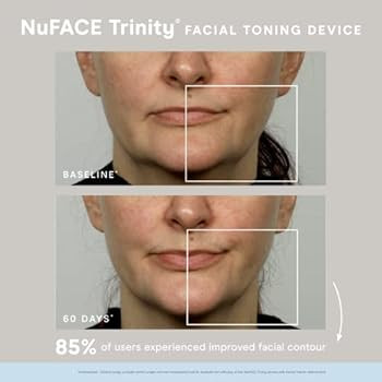 NuFACE Trinity Starter Kit - Facial Toning Device | Amazon (US)