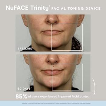 NuFACE Trinity Starter Kit - Facial Toning Device | Amazon (US)