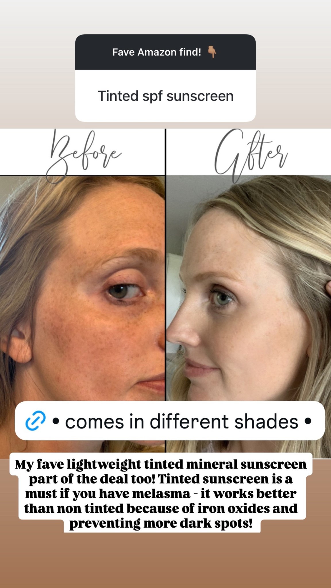 My fave lightweight tinted mineral sunscreen part of the deal too! Tinted sunscreen is a must if you have melasma - it works better than non tinted because of iron oxides and preventing more dark spots!