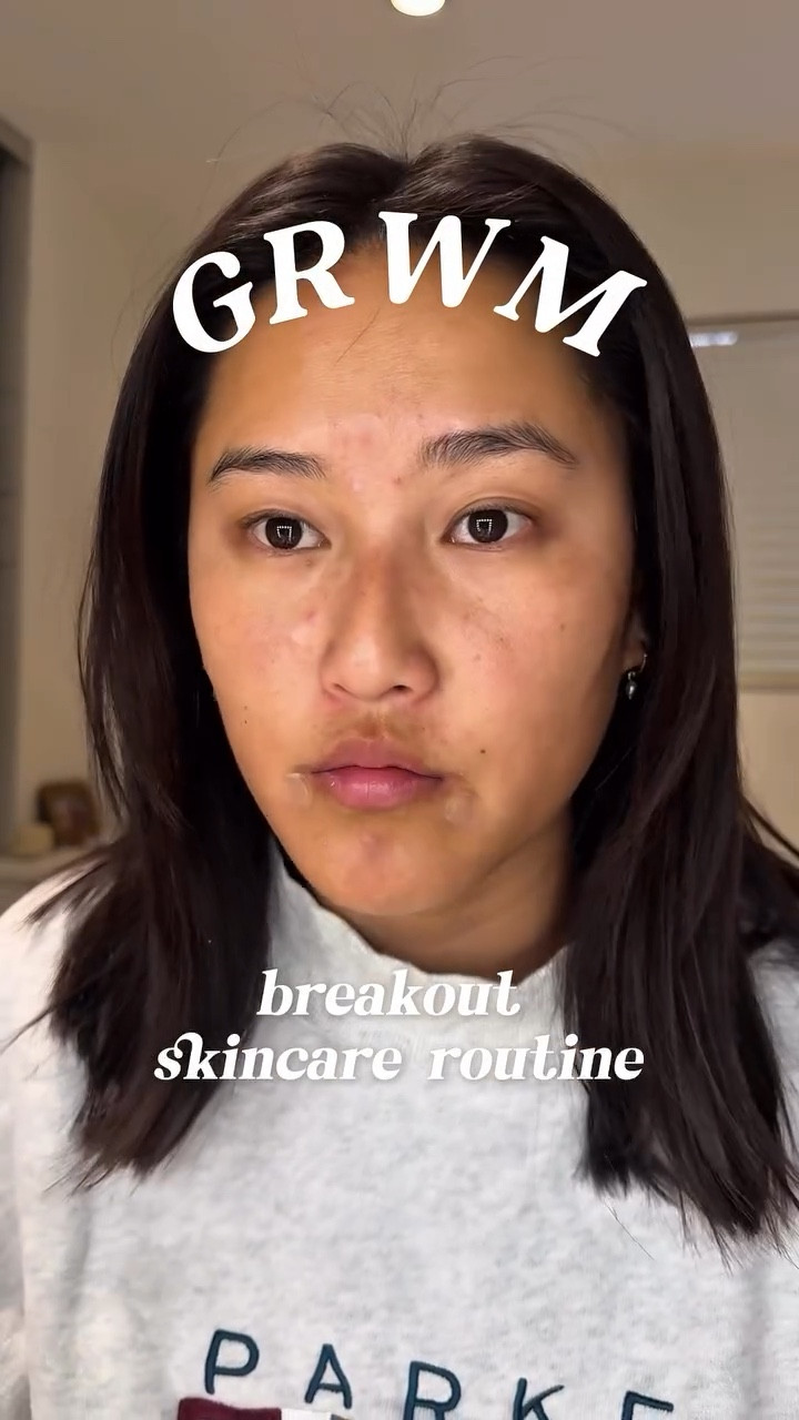 idk why my skins been freaking out lately but this is what i normally do to help clear my skin back up🫧 it’ll take a few weeks so follow along the journey lol 

products used:
pimple patches @get_rael & @cetaphil 
@shiseido deep cleansing foam face wash
@rodanandfields active hydration serum 
@kiehls ultra facial cream
@theordinary sunscreen 

#skincareroutine #clearskinroutine #breakouts #skincarejourney #healthyskin