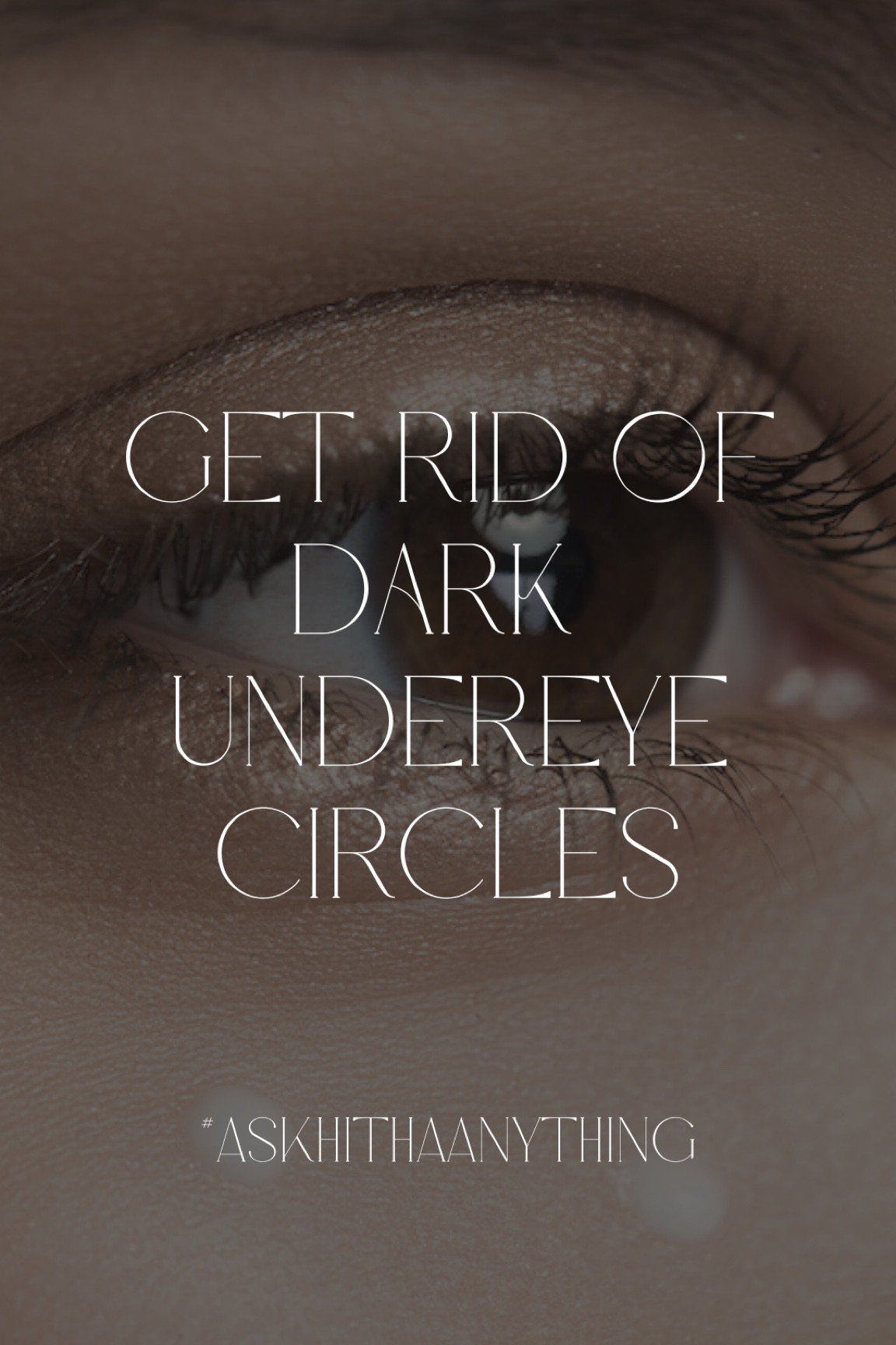 Genetics, sleep (or lack thereof), and hydration are some of the largest contributors to undereye dark circles. I’d try to get more sleep and drink more water, but I’m linking some of my favorite skincare and makeup to help treat and hide them as well:
Sunday Riley’s Auto-correct, Wander Beauty’s Baggage Claim eye cream, and Alchimie Forever’s tightening eye gel are some of the best brightening and hydrating eye creams on the market.
Live Tinted’s Huestick (I use perk) is a great color corrector for hiding undereye circles. I also love their Hueskin concealer (I use shade 13) and Rare Beauty’s undereye brightener over the color corrector, and that’s worked quite well for me!

#LTKbeauty #LTKfindsunder100 #LTKsalealert