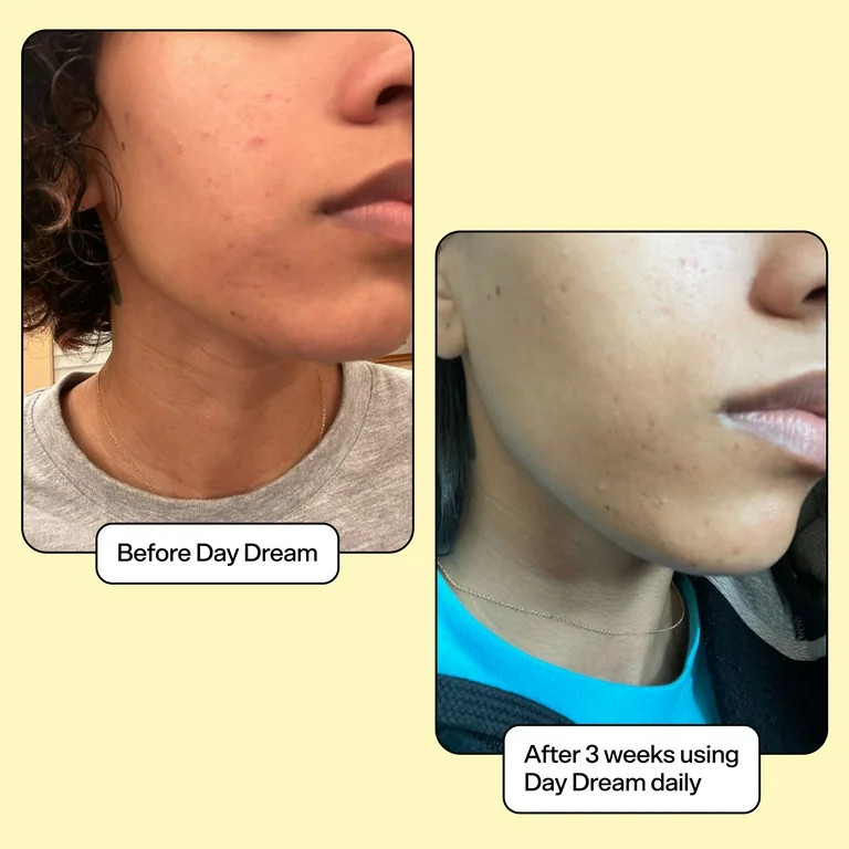 Bubble Skincare Day Dream Serum with Vit C & Niacinamide, Even Tone & Dark Spots, All Skin Types,... | Walmart (US)