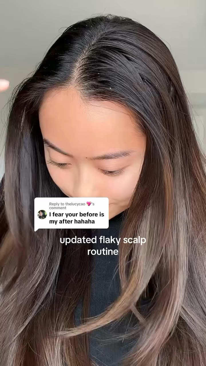 my updated flaky scalp routine! I find that using hair oil also helps with my hair growth, so it’s like shooting two birds with one stone 🤗 

Hair oil @fableandmane 
Scalp massager @vegamour (“CALISTA” for 20% off)
Glycolic acid @theordinary 
Hair dryer @dysonbeauty 

#glycolicacidforhair #flakyscalp #dandruffsolution